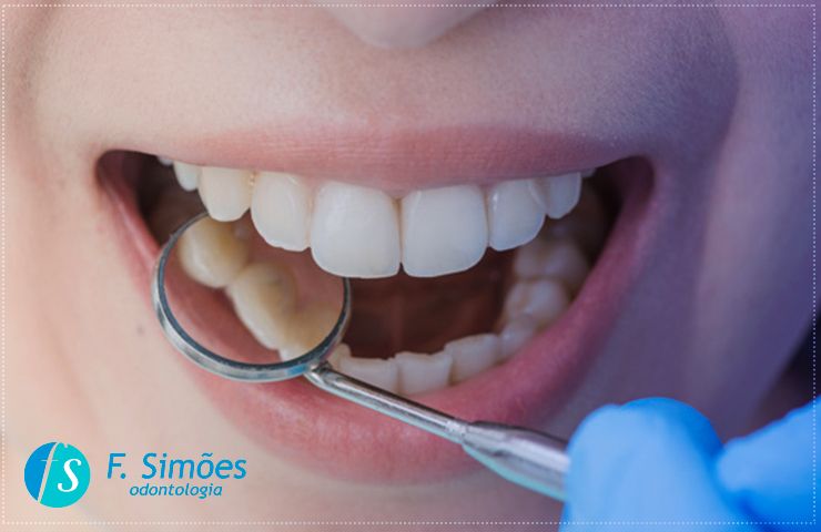 Periodontia a área odontológica que cuida da sua gengivite.