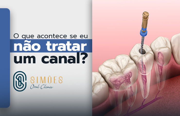 O que acontece se eu não tratar um canal?