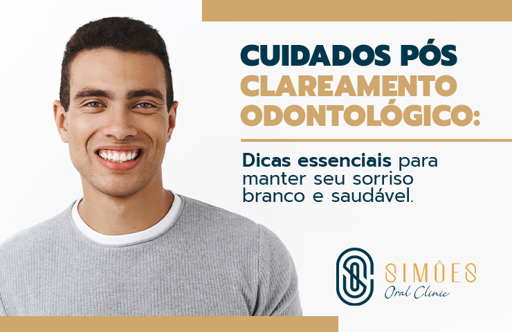 Cuidados pós clareamento odontológico: Dicas essenciais para manter seu sorriso branco e saudável
