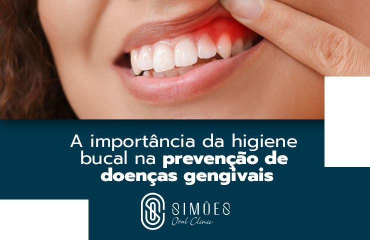 A importância da higiene bucal na prevenção de doenças gengivais
